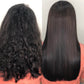 ENCODE STRAIGHTENING TREATMENT